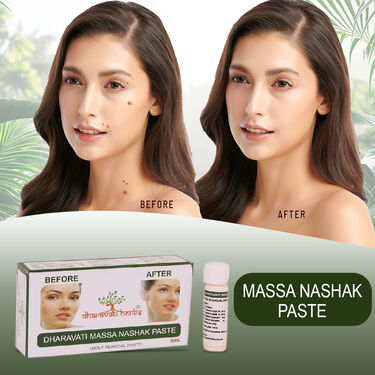 Ayurvedic Massa Removal Cream