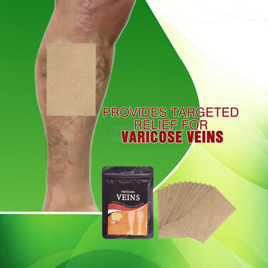 Varicose Pain Relief Patches Pack of 12 (PRS113)